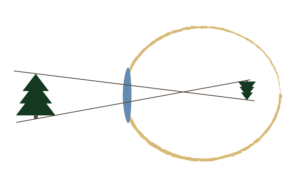 oeil myope en phase 2