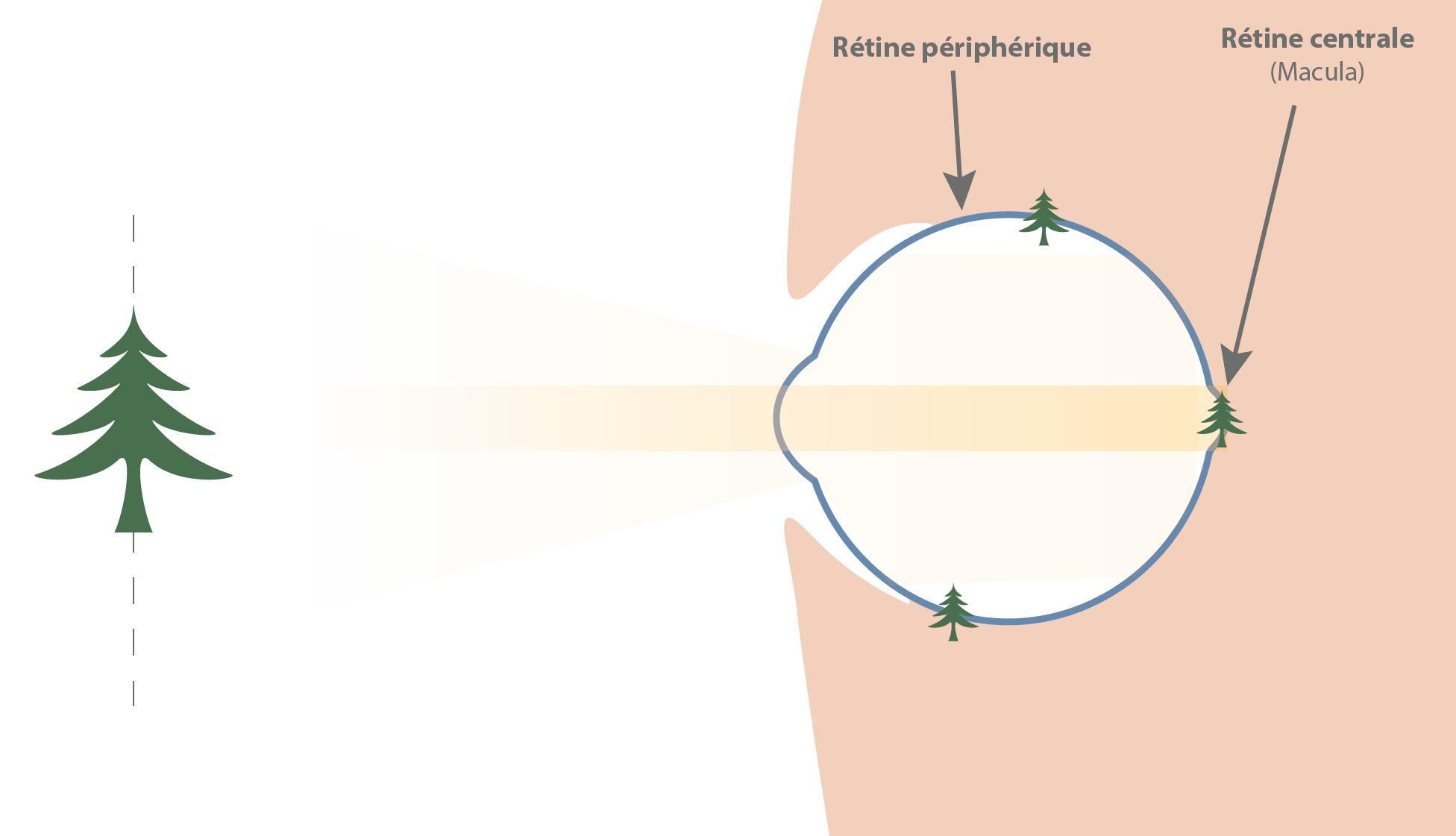 Les verres freinateurs de myopie : une bonne idée ? 5 oeil parfait vision nette